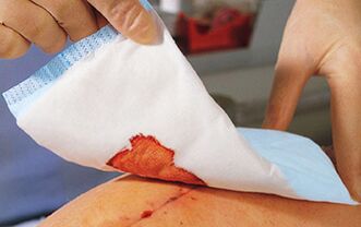 After penis enlargement surgery, bandages are required