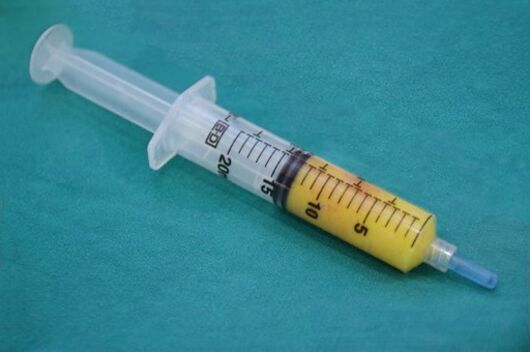 The syringe has adipose tissue to fill with fat