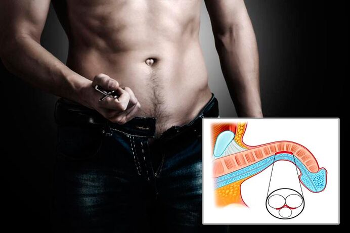 Man takes off his pants to practice penis enlargement